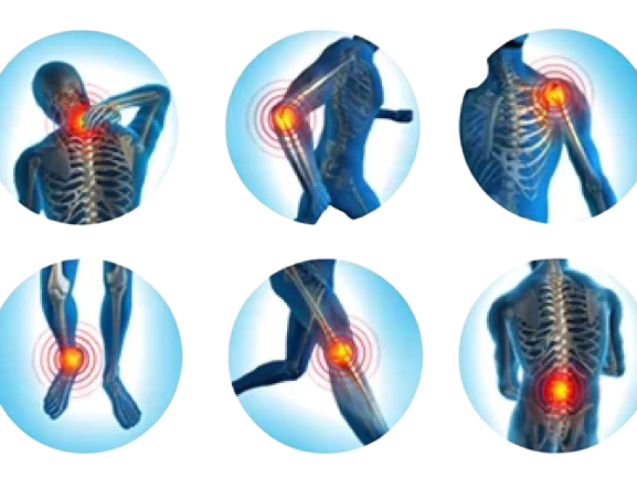 Joints-Pain